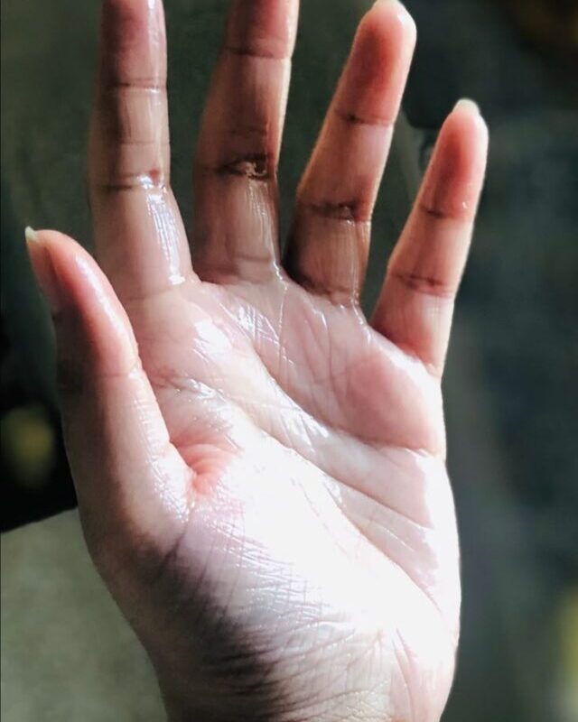 Sweaty Hands